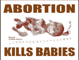 anti abortion yard sign